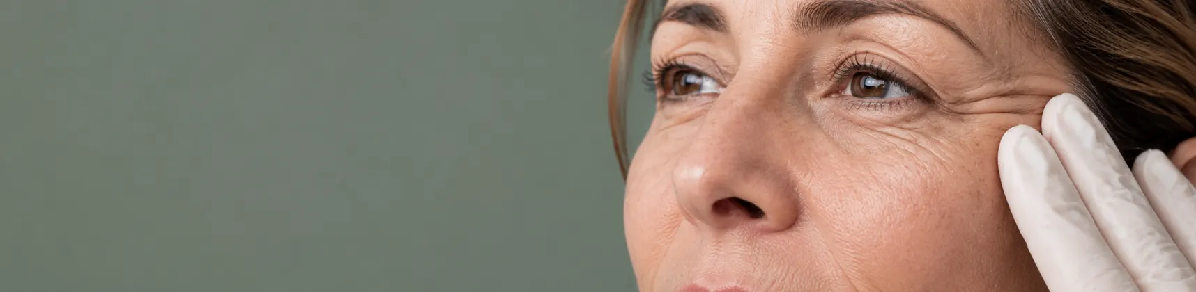 Wrinkles & Fine Lines